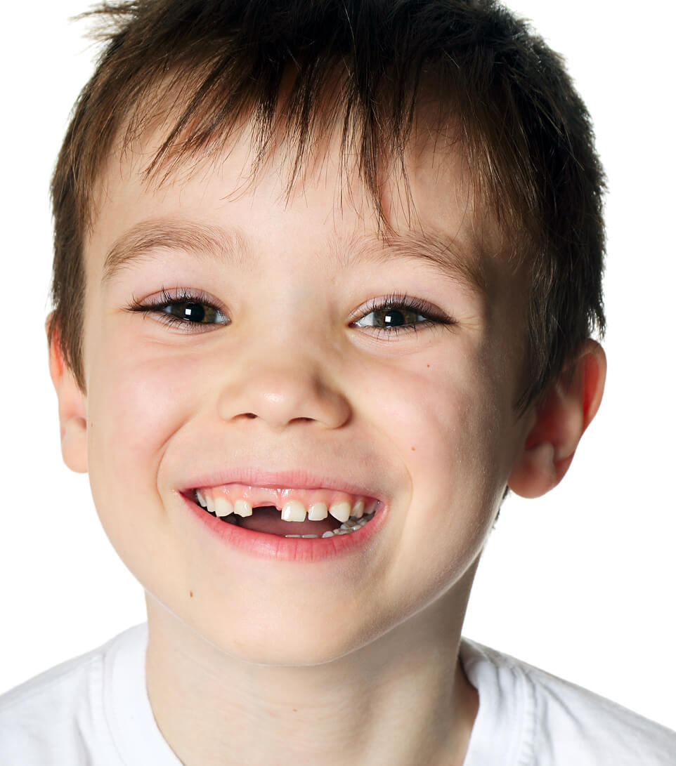 Child With Missing Front Tooth