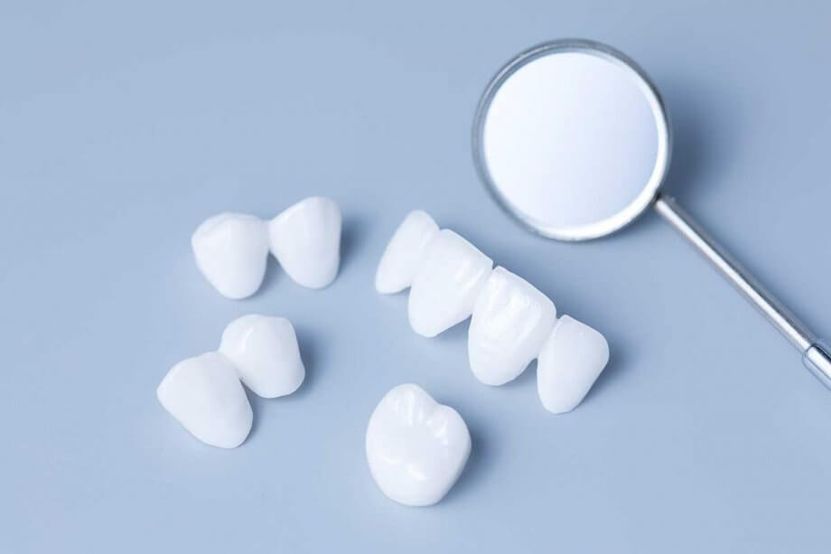 How Porcelain Veneers Can Improve Your Smile
